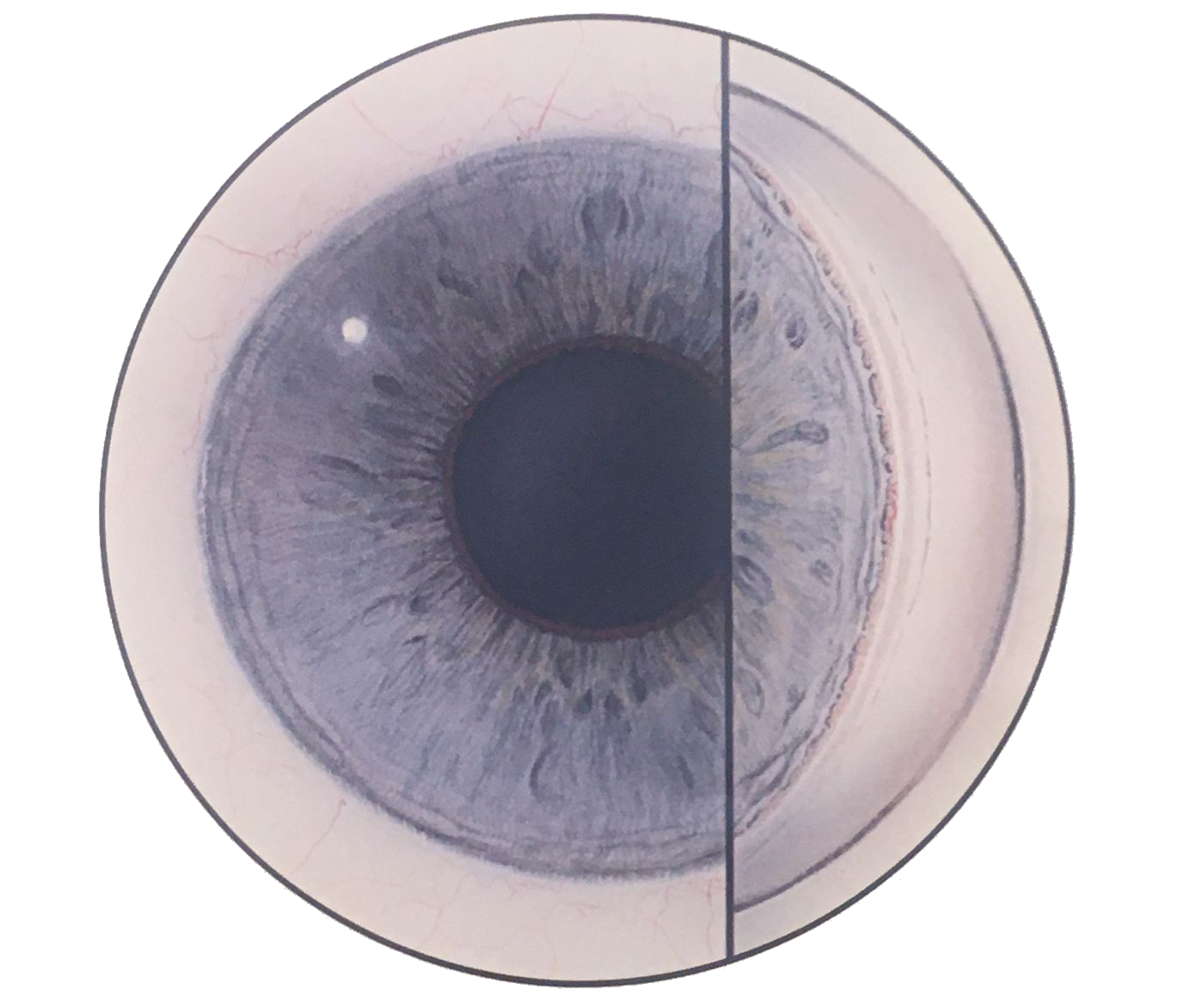 Primary Open Angle Glaucoma - Mr Eyes